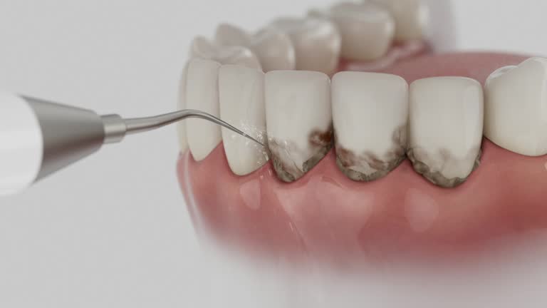 Reliable Emergency Dentist contractor in Oneonta, NY by Smile Center Dentistry